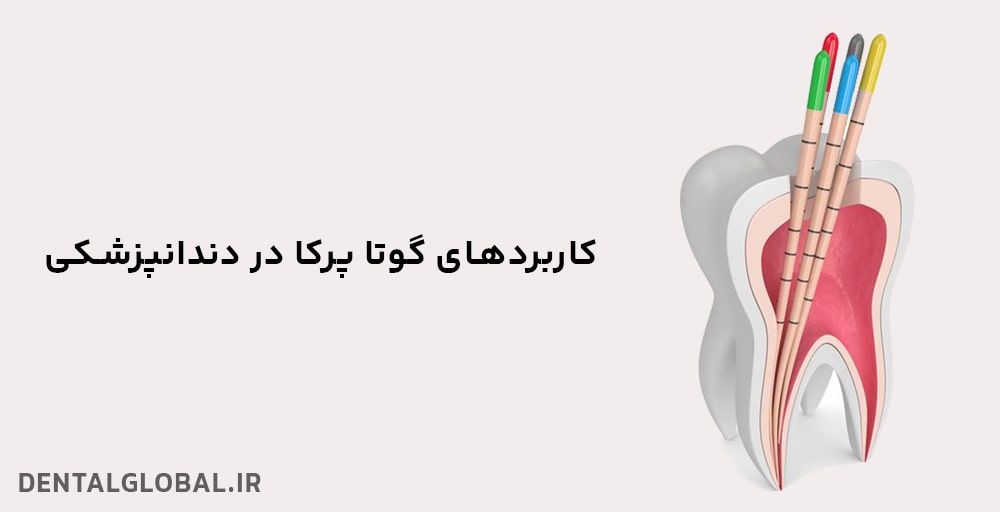 کاربردهای گوتا پرکا