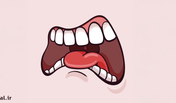 علائم سرطان دهان